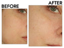 How to Minimise Large Pores: 4 Steps That Work