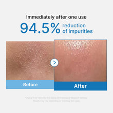 Medicube Zero Pore Blackhead Deep Cleansing Oil 205ml image 3