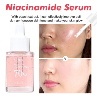 Kōra Lab Niacinamide 10% + Arbutin Dark Spot Serum — 30ml